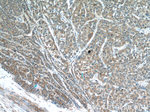 IDH1 Antibody in Immunohistochemistry (Paraffin) (IHC (P))