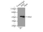 IDH1 Antibody in Immunoprecipitation (IP)