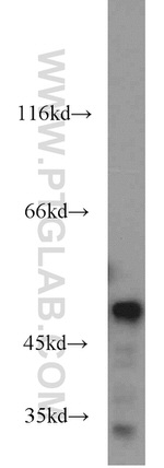 IDH1 Antibody in Western Blot (WB)