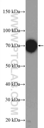 UBE3C Antibody in Western Blot (WB)