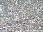 SDPR Antibody in Immunohistochemistry (Paraffin) (IHC (P))