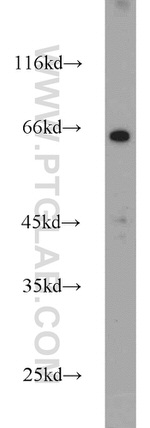 SDPR Antibody in Western Blot (WB)