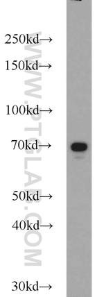 SDPR Antibody in Western Blot (WB)