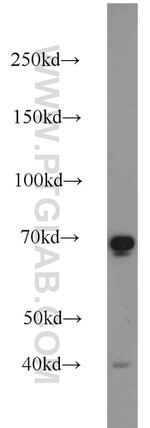 SDPR Antibody in Western Blot (WB)