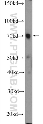 SDPR Antibody in Western Blot (WB)