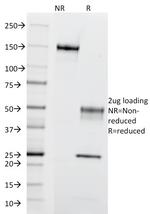 CD195 (CC-Chemokine Receptor 5) Antibody in SDS-PAGE (SDS-PAGE)