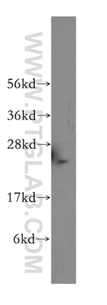 PSMD10 Antibody in Western Blot (WB)