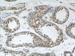 DYNC1H1 Antibody in Immunohistochemistry (Paraffin) (IHC (P))