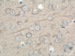 DYNC1H1 Antibody in Immunohistochemistry (Paraffin) (IHC (P))