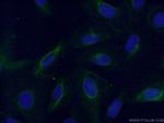 FABP5 Antibody in Immunocytochemistry (ICC/IF)