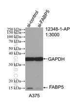 FABP5 Antibody in Western Blot (WB)