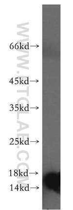 FABP5 Antibody in Western Blot (WB)