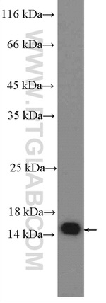 FABP5 Antibody in Western Blot (WB)