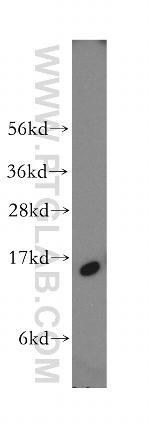 FABP5 Antibody in Western Blot (WB)