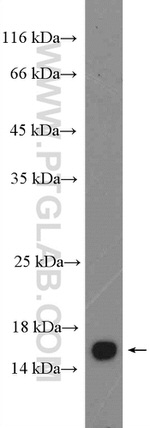 FABP5 Antibody in Western Blot (WB)