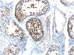 CABYR Antibody in Immunohistochemistry (Paraffin) (IHC (P))