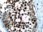 CABYR Antibody in Immunohistochemistry (Paraffin) (IHC (P))