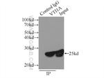 VTI1A Antibody in Immunoprecipitation (IP)