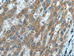 NDUFB3 Antibody in Immunohistochemistry (Paraffin) (IHC (P))