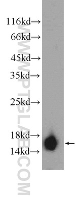 Hemoglobin epsilon Antibody in Western Blot (WB)