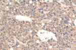 DNAJC1 Antibody in Immunohistochemistry (Paraffin) (IHC (P))