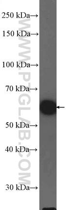 KPNA6 Antibody in Western Blot (WB)