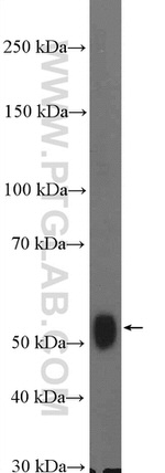 KPNA6 Antibody in Western Blot (WB)