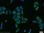 DPH2 Antibody in Immunocytochemistry (ICC/IF)