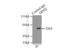 DPH2 Antibody in Immunoprecipitation (IP)