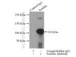 Sortilin Antibody in Immunoprecipitation (IP)