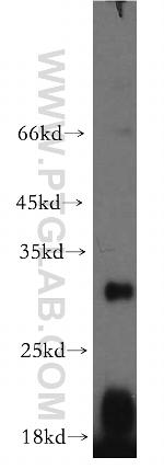 EBI3 Antibody in Western Blot (WB)