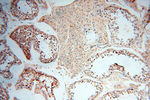 COX2 Antibody in Immunohistochemistry (Paraffin) (IHC (P))