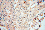 COX2 Antibody in Immunohistochemistry (Paraffin) (IHC (P))