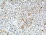 COX2 Antibody in Immunohistochemistry (Paraffin) (IHC (P))