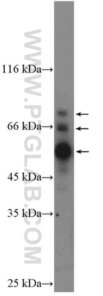 COX2 Antibody in Western Blot (WB)