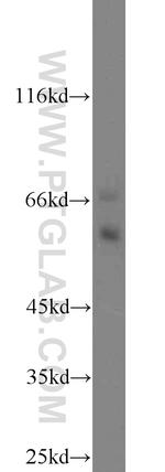 COX2 Antibody in Western Blot (WB)