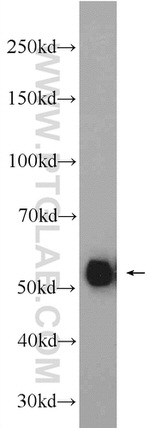 COX2 Antibody in Western Blot (WB)