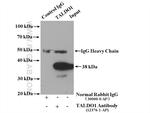 TALDO1 Antibody in Immunoprecipitation (IP)