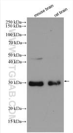HDGFRP3 Antibody in Western Blot (WB)