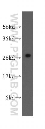 HDGFRP3 Antibody in Western Blot (WB)