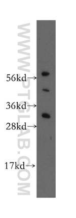 HDGFRP3 Antibody in Western Blot (WB)