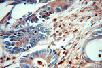 PD-ECGF Antibody in Immunohistochemistry (Paraffin) (IHC (P))