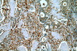 PD-ECGF Antibody in Immunohistochemistry (Paraffin) (IHC (P))