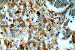 PD-ECGF Antibody in Immunohistochemistry (Paraffin) (IHC (P))