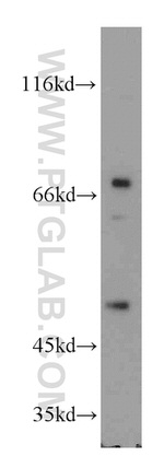 PD-ECGF Antibody in Western Blot (WB)