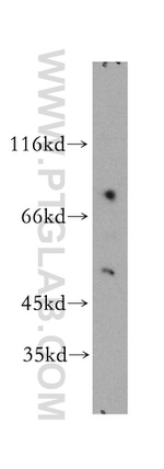 PD-ECGF Antibody in Western Blot (WB)