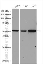 PD-ECGF Antibody in Western Blot (WB)