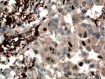 PD-ECGF Antibody in Immunohistochemistry (Paraffin) (IHC (P))