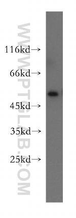 PD-ECGF Antibody in Western Blot (WB)