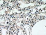 UBAP1 Antibody in Immunohistochemistry (Paraffin) (IHC (P))